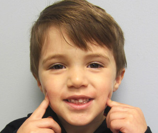 Boy with missing upper tooth pointing to his smile