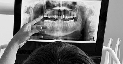 Panoramic dental x-ray