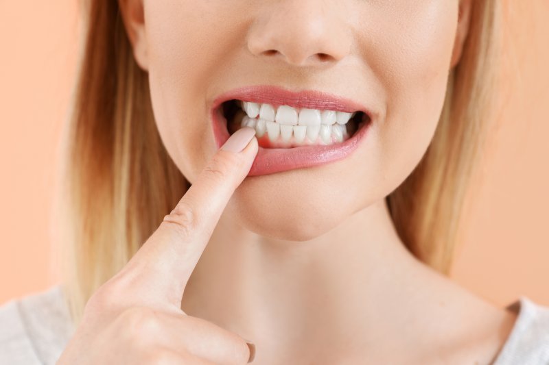 an up-close view of a woman exposing her lower gums that are red 